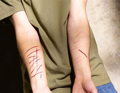 fresh sh pics|Self Harm: Pictures, Photos, Images of Self Mutilation.